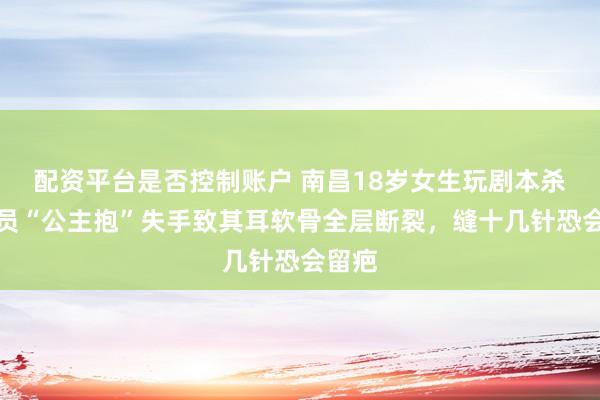 配资平台是否控制账户 南昌18岁女生玩剧本杀，店员“公主抱”失手致其耳软骨全层断裂，缝十几针恐会留疤